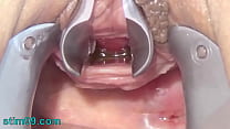 free com masturbate peehole with toothbrush and chain into urethra free